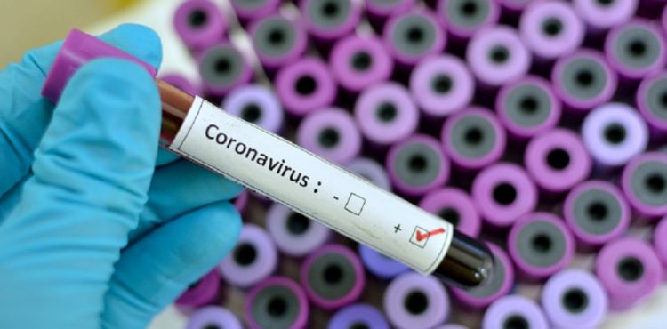 Brasil registra 1.757 mortos e 28,6 mil casos de coronavírus