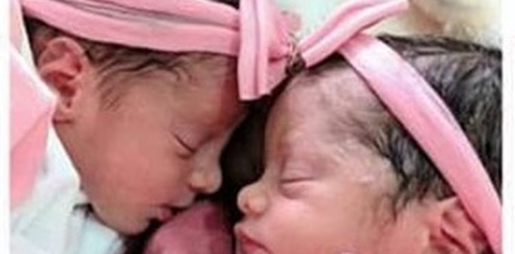 Polícia investiga morte de recém-nascidas gêmeas que foram atacadas por cachorro da família na Bahia