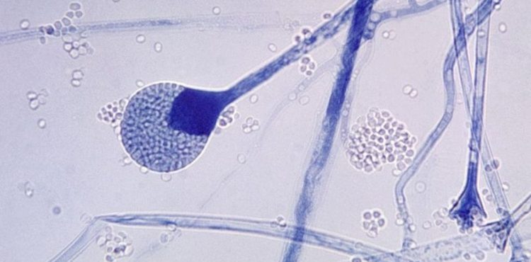 Mucormicose: 5 perguntas-chave sobre infecção rara que mutila e mata pacientes de covid na Índia