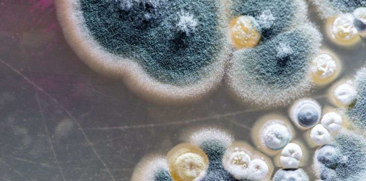 Pernambuco registra caso de mucormicose em paciente que teve Covid-19