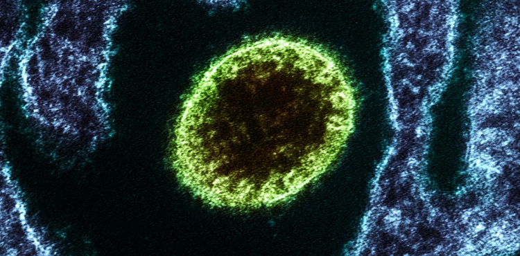 Vírus Nipah pode causar próxima pandemia, diz pesquisadora de Oxford