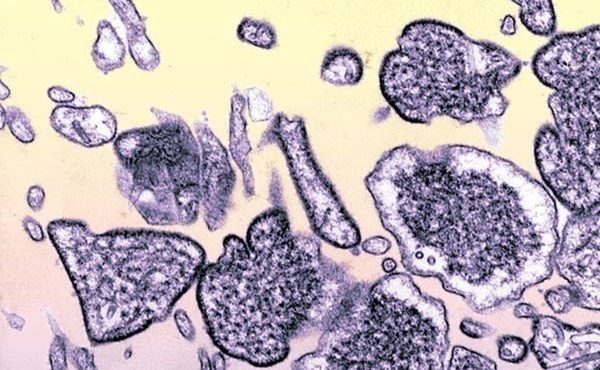Saiba os sintomas e como se prevenir do vírus Nipah, que pode causar próxima pandemia