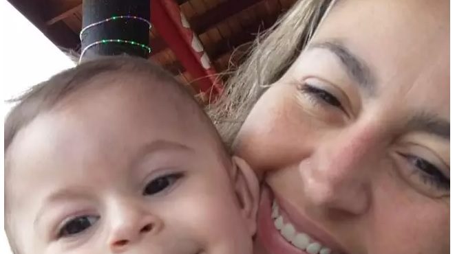 Em caso raríssimo, bebê com três braços passa por amputação