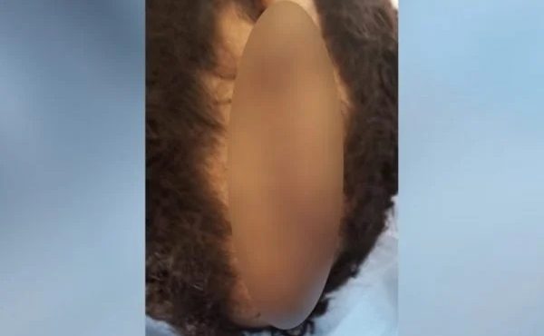 Pai escalpela filho de 10 anos em Goiás por não gostar de corte de cabelo