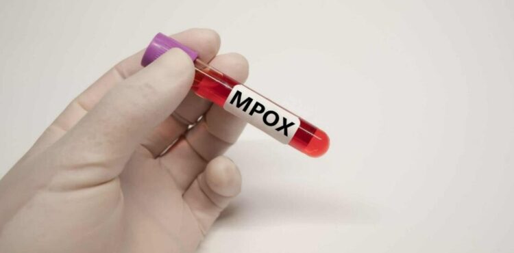 Mpox: quem corre mais risco de se infectar?